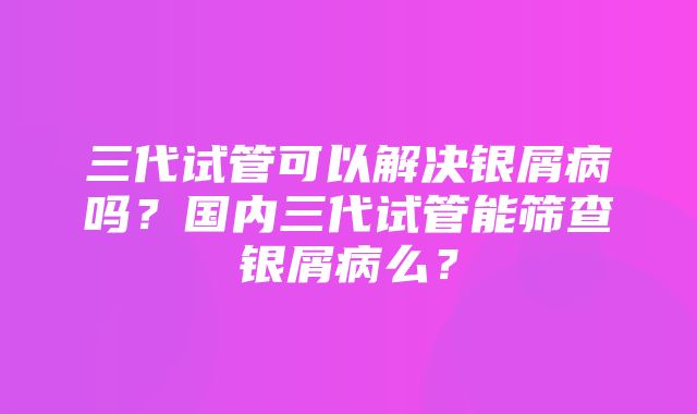 三代试管可以解决银屑病吗？国内三代试管能筛查银屑病么？