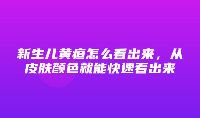 新生儿黄疸怎么看出来，从皮肤颜色就能快速看出来