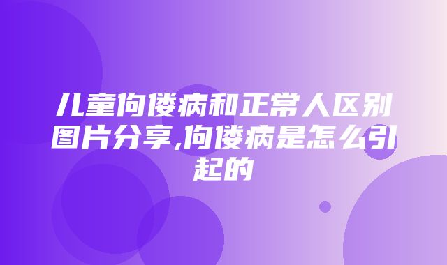 儿童佝偻病和正常人区别图片分享,佝偻病是怎么引起的