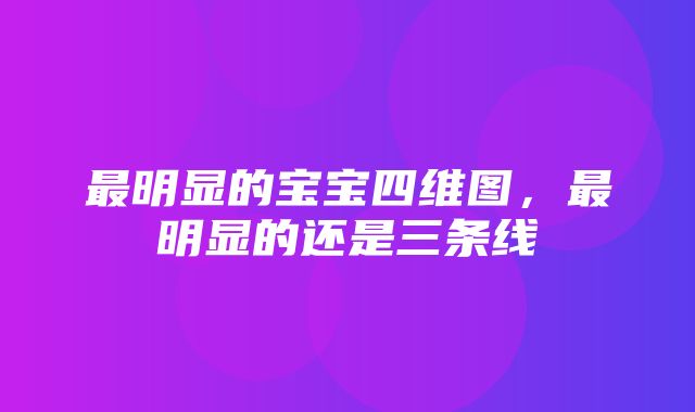 最明显的宝宝四维图，最明显的还是三条线