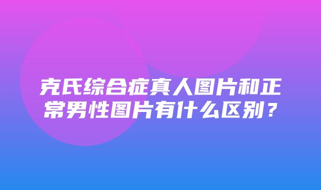 克氏综合症真人图片和正常男性图片有什么区别？