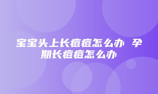 宝宝头上长痘痘怎么办 孕期长痘痘怎么办