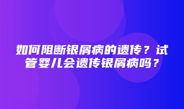 如何阻断银屑病的遗传？试管婴儿会遗传银屑病吗？