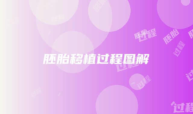 胚胎移植过程图解