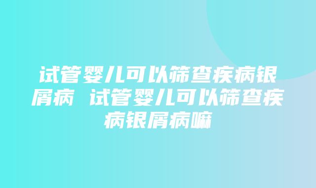 试管婴儿可以筛查疾病银屑病 试管婴儿可以筛查疾病银屑病嘛