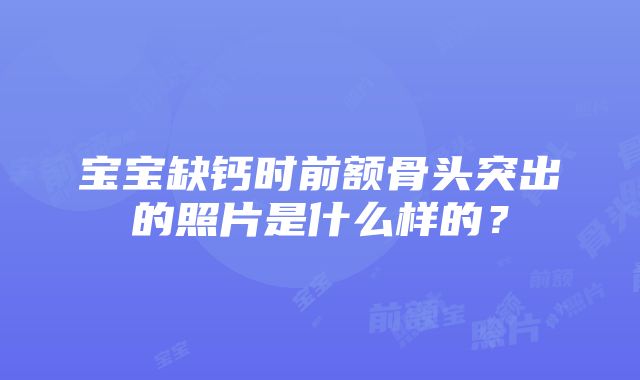 宝宝缺钙时前额骨头突出的照片是什么样的？