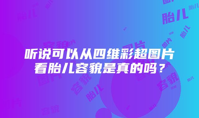 听说可以从四维彩超图片看胎儿容貌是真的吗？