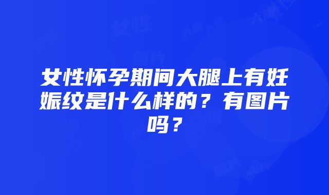 女性怀孕期间大腿上有妊娠纹是什么样的？有图片吗？