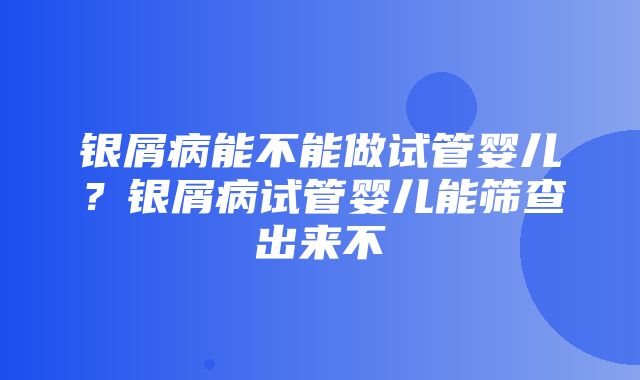 银屑病能不能做试管婴儿？银屑病试管婴儿能筛查出来不