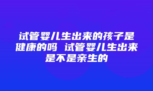 试管婴儿生出来的孩子是健康的吗 试管婴儿生出来是不是亲生的