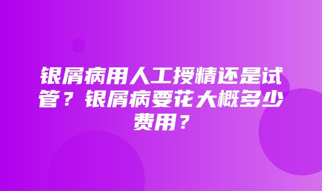 银屑病用人工授精还是试管？银屑病要花大概多少费用？