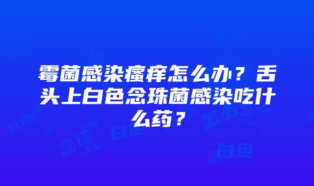 霉菌感染瘙痒怎么办？舌头上白色念珠菌感染吃什么药？