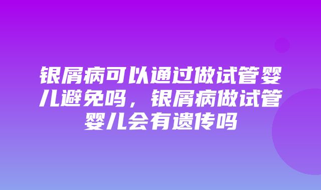 银屑病可以通过做试管婴儿避免吗，银屑病做试管婴儿会有遗传吗