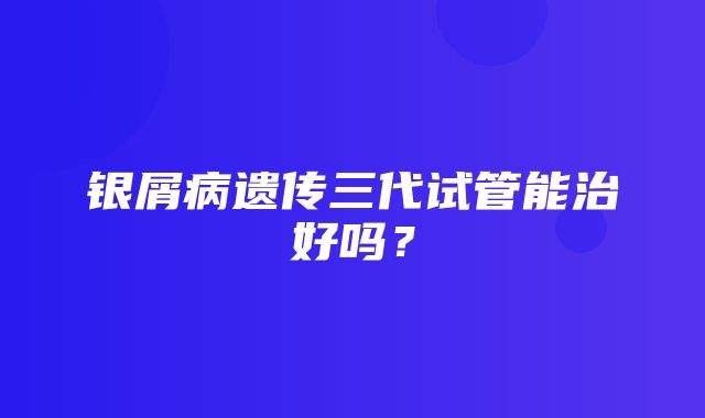 银屑病遗传三代试管能治好吗？