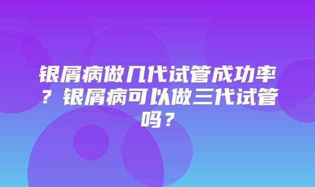 银屑病做几代试管成功率？银屑病可以做三代试管吗？