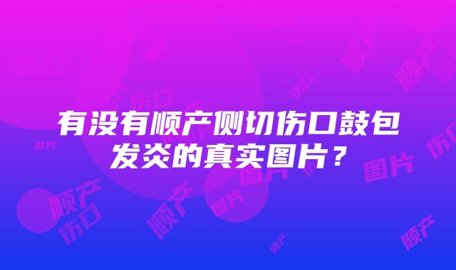 有没有顺产侧切伤口鼓包发炎的真实图片？