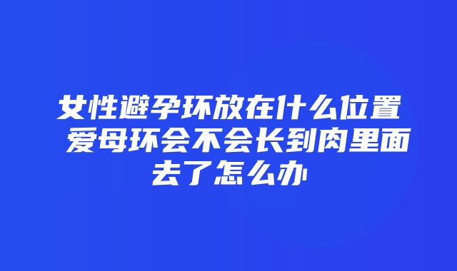 女性避孕环放在什么位置 爱母环会不会长到肉里面去了怎么办