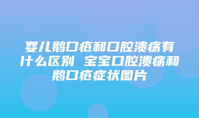 婴儿鹅口疮和口腔溃疡有什么区别 宝宝口腔溃疡和鹅口疮症状图片