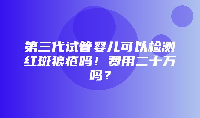 第三代试管婴儿可以检测红斑狼疮吗！费用二十万吗？