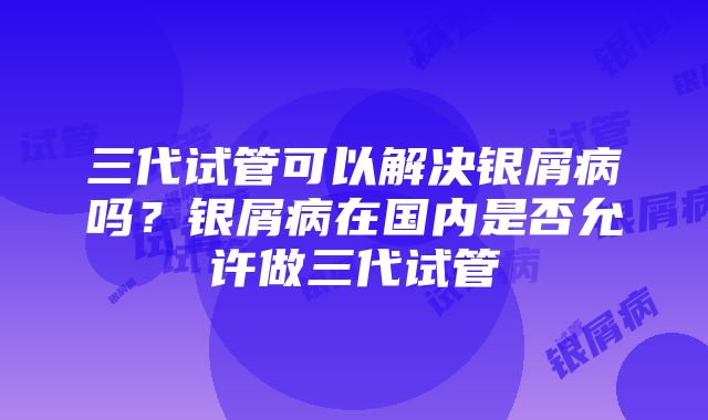 三代试管可以解决银屑病吗？银屑病在国内是否允许做三代试管