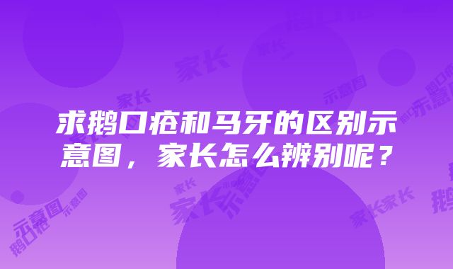 求鹅口疮和马牙的区别示意图，家长怎么辨别呢？