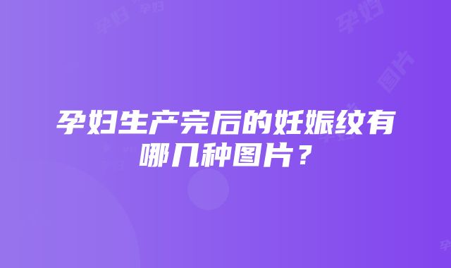 孕妇生产完后的妊娠纹有哪几种图片？