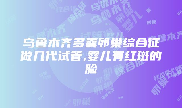 乌鲁木齐多囊卵巢综合征做几代试管,婴儿有红斑的脸