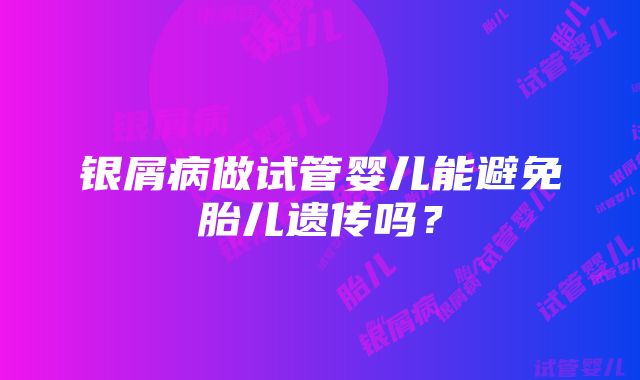 银屑病做试管婴儿能避免胎儿遗传吗？