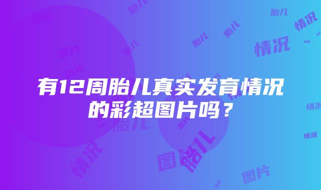 有12周胎儿真实发育情况的彩超图片吗？