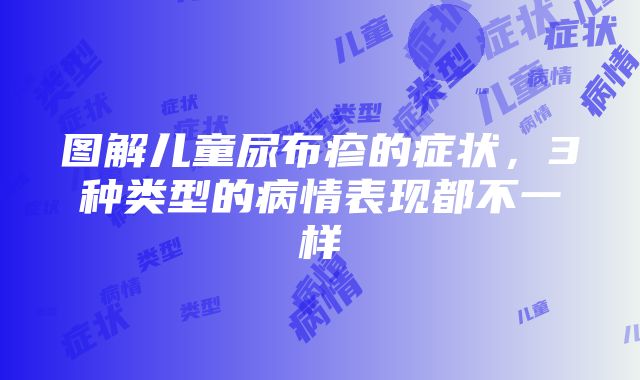 图解儿童尿布疹的症状，3种类型的病情表现都不一样