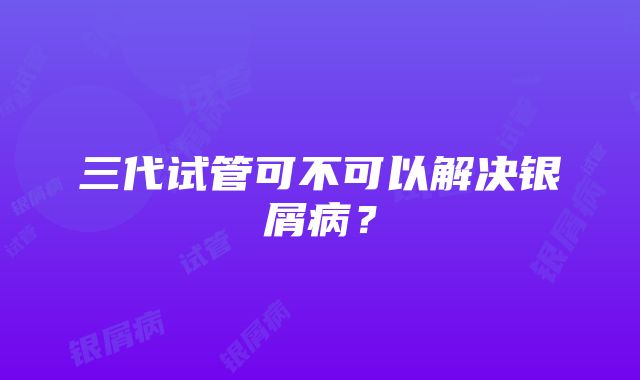 三代试管可不可以解决银屑病？