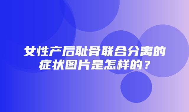 女性产后耻骨联合分离的症状图片是怎样的？