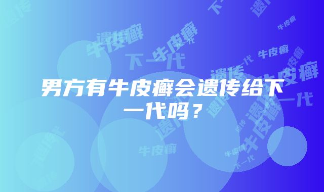 男方有牛皮癣会遗传给下一代吗？