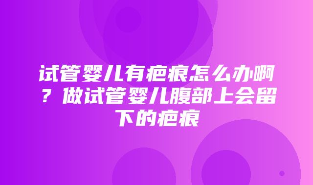 试管婴儿有疤痕怎么办啊？做试管婴儿腹部上会留下的疤痕