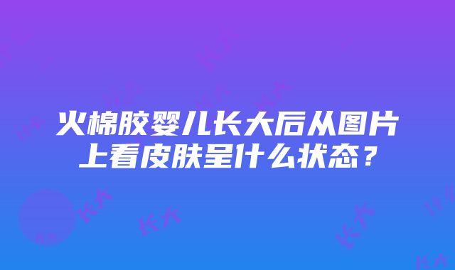 火棉胶婴儿长大后从图片上看皮肤呈什么状态？