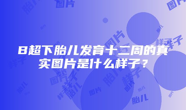 B超下胎儿发育十二周的真实图片是什么样子？