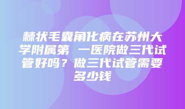 棘状毛囊角化病在苏州大学附属第 一医院做三代试管好吗？做三代试管需要多少钱