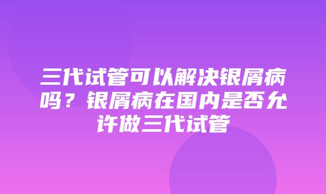 三代试管可以解决银屑病吗？银屑病在国内是否允许做三代试管