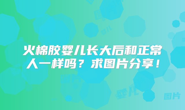 火棉胶婴儿长大后和正常人一样吗？求图片分享！