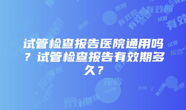 试管检查报告医院通用吗？试管检查报告有效期多久？