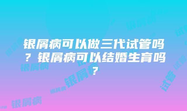 银屑病可以做三代试管吗？银屑病可以结婚生育吗？