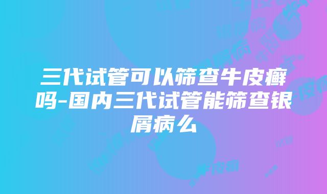 三代试管可以筛查牛皮癣吗-国内三代试管能筛查银屑病么