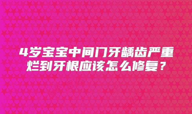 4岁宝宝中间门牙龋齿严重烂到牙根应该怎么修复？